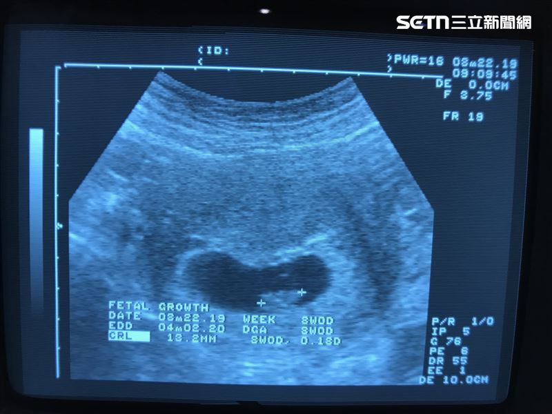 去年爆發的海外代孕機構違法詐騙案中，竟有連取卵都尚未進行就傳送超音波照片的情況。（圖／讀者提供）