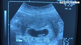 去年爆發的海外代孕機構違法詐騙案中，竟有連卵子取都尚未取得傳送超音波照片的情況。（圖／讀者提供）