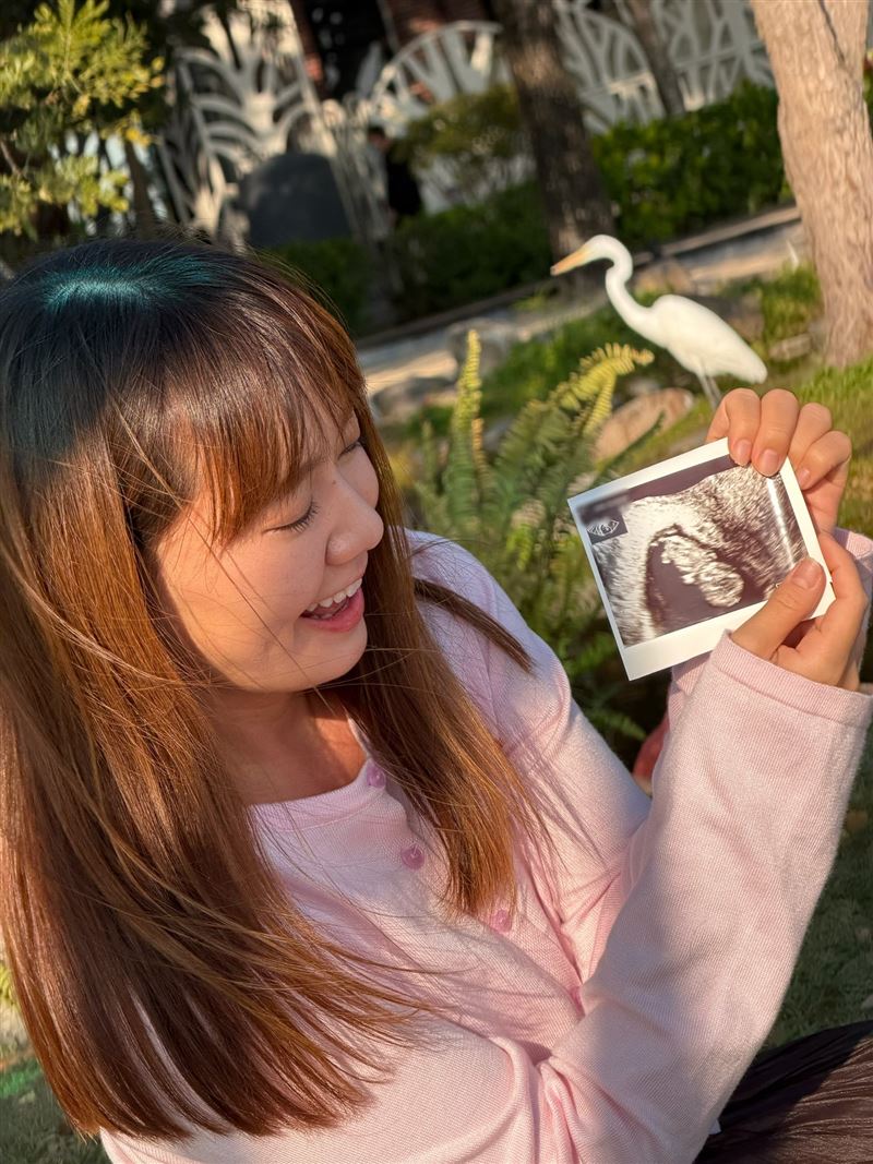 「我是Mana」喜曬超音波．（圖／翻攝自我是Mana臉書）
