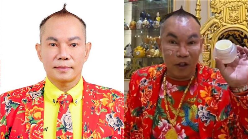 吊車王遭酸醫美打太多!他靠1物臉膨起來