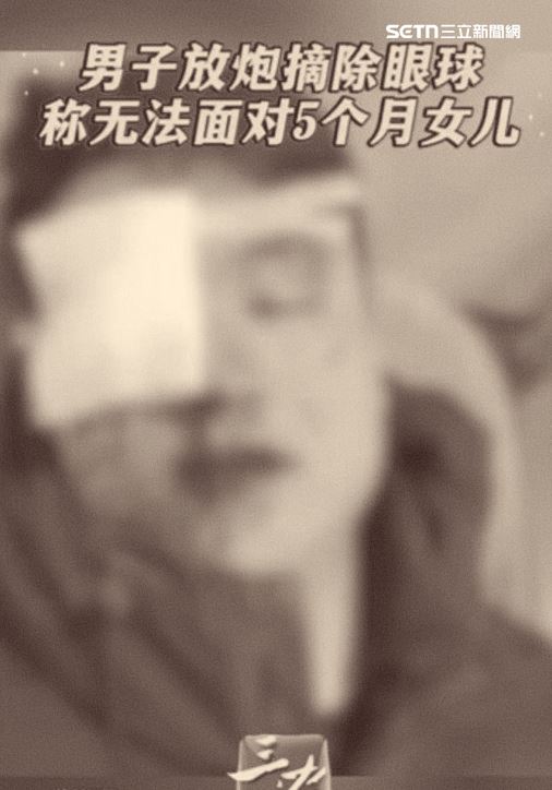 男子在燃放高空煙火時，因安全距離不足或產品瑕疵，導致眼球遭煙火直接擊中並炸裂，送醫後直接強摘眼球保命。(圖/翻攝微博)