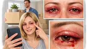 砸1200萬買房卻變醜！人妻入住慘遭「毀容」眼睛出血腫脹…掀地毯嚇瘋（示意圖／三立新聞網生活中心製作） 