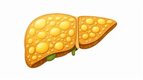 脂肪肝。（圖／AI製圖）