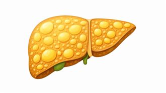 不是酒、比肥肉恐怖！醫揭脂肪肝隱形元凶