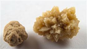 義大利有竊賊闖空門在公寓內偷走看似裝有黃金的寶盒，結果屋主返家發現，被偷的只是他的腎結石，圖為腎結石示意圖。（AI生成圖）