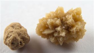 義大利有竊賊闖空門在公寓內偷走看似裝有黃金的寶盒，結果屋主返家發現，被偷的只是他的腎結石，圖為腎結石示意圖。（AI生成圖）