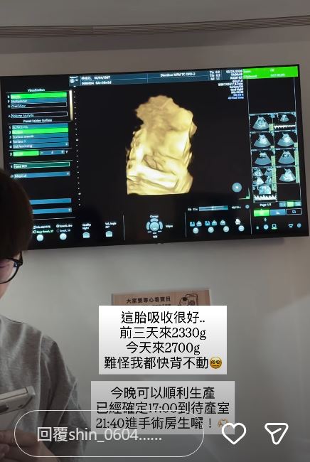 饅頭媽預計今晚生產。（圖／翻攝自饅頭媽IG）