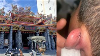 桃園慈護宮領發財金　換人排隊遭甩棍爆耳