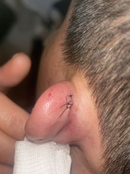 黃小姐推著輪椅上媽媽和弟媳「換人排隊」，遭廟方工作人員怒罵插隊「甩棍爆耳」縫3針。（圖／翻攝自「桃園爆報(二)」臉書）