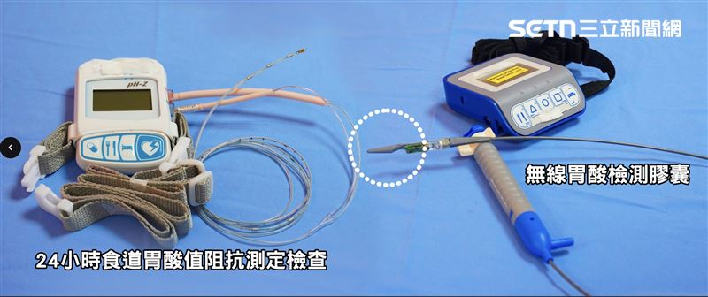 不再靠藥撐！40歲上班族受夠「火燒心」，奇美醫1招助他找回生活品質。（圖／奇美醫院提供）