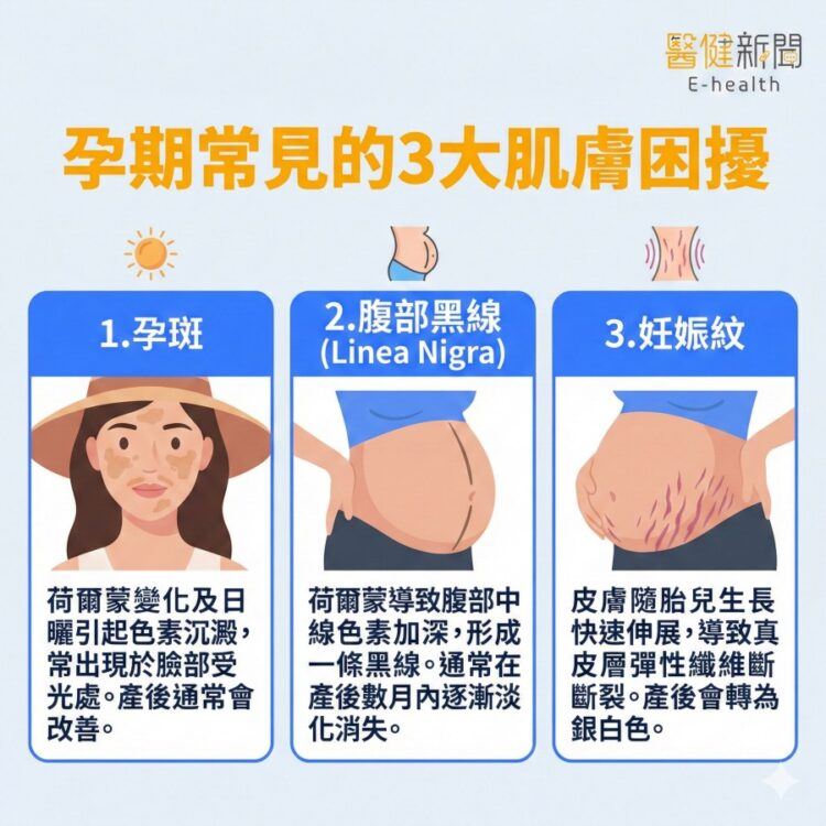 孕期常見的3大肌膚困擾！ （圖／醫健新聞網提供）