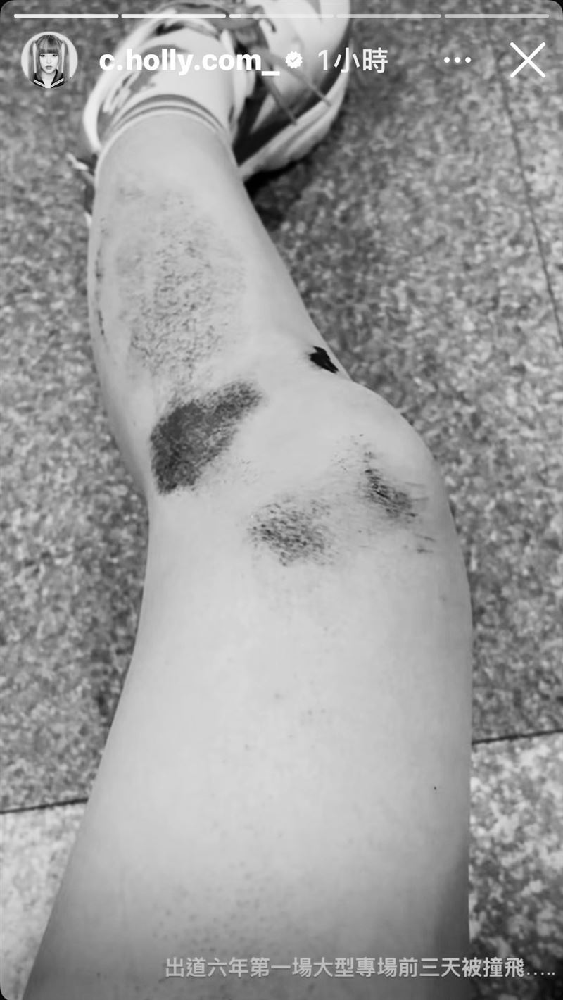 大嘻哈C.Holly嚴重車禍。（圖／翻攝自C.Holly IG）