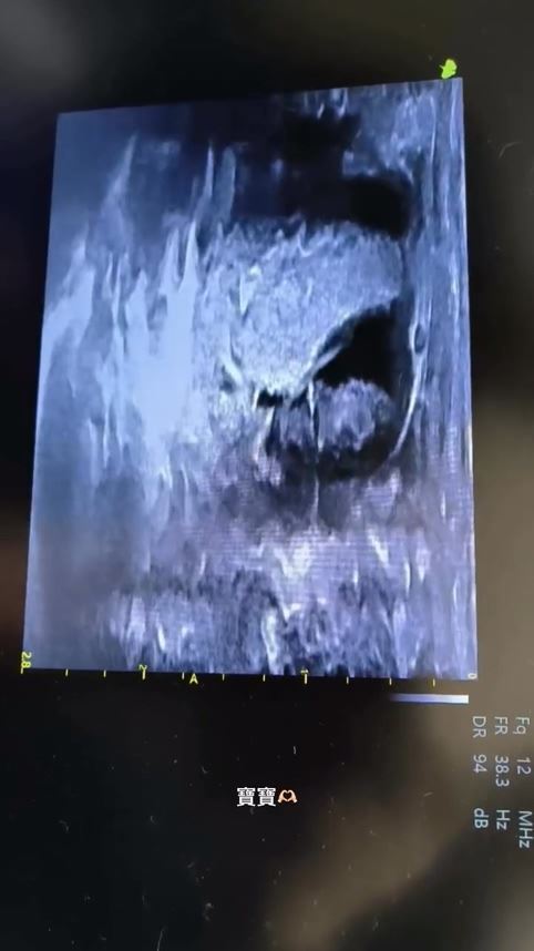 花花分享家中南美栗鼠超音波畫面。（圖／翻攝自花花IG）