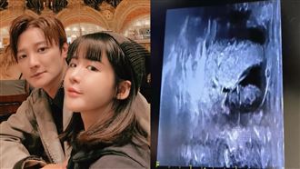 阿沁嫩妻花花PO超音波照　疑懷3胎回應了