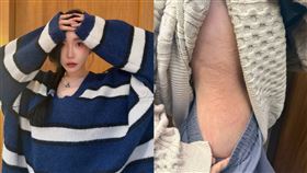 許允樂飽受蕁麻疹困擾。（圖／翻攝自IG）