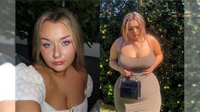 不靠瘦瘦針！澳女「逛動物園」年瘦20公斤(圖/翻攝IG)