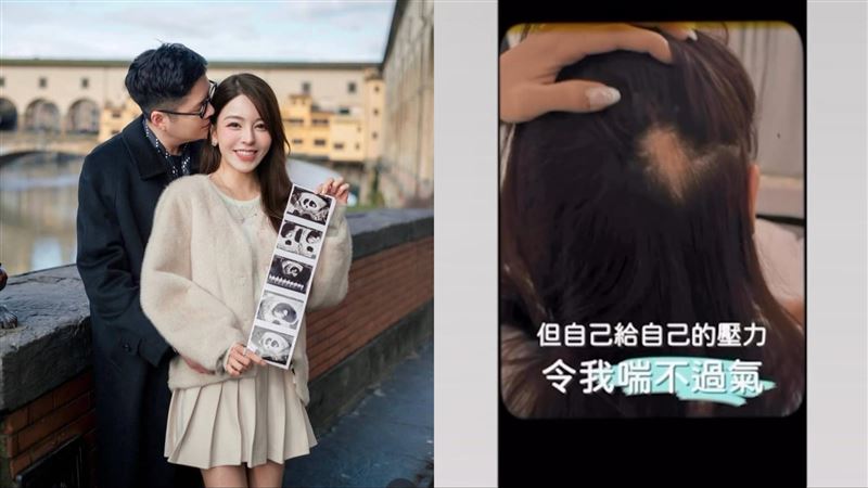 女星試管懷雙胞胎 求子爆併發症:都腹水