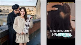 女星試管懷雙胞胎　求子爆併發症：都腹水