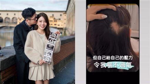 女星試管懷雙胞胎　求子爆併發症：都腹水