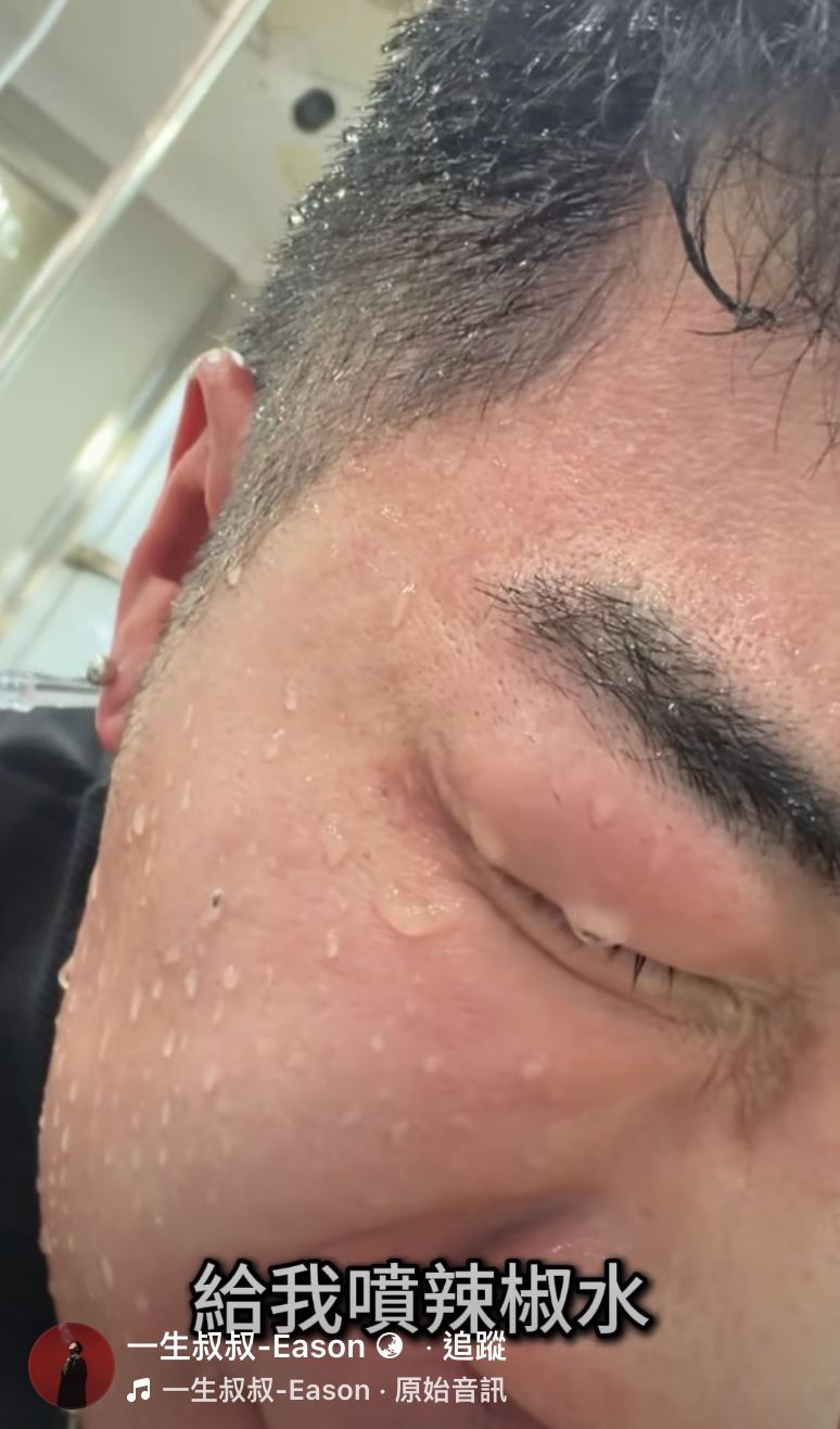 「一生叔叔」在臉書公開遭攻擊影片。(圖/翻攝自臉書「一生叔叔-Eason」)