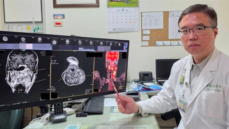 耳鳴聽力下降?50歲男檢查驚鼻咽癌第三期