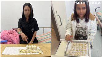 口吞肛塞115顆毒球！2女運毒被抓下場曝