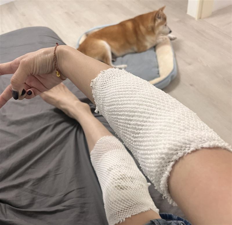 胡嘉愛傷勢曝光。(圖/翻攝自胡嘉愛臉書)