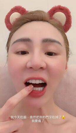 短今曬自拍照透露不幸把門牙吃掉。（圖／翻攝自IG）