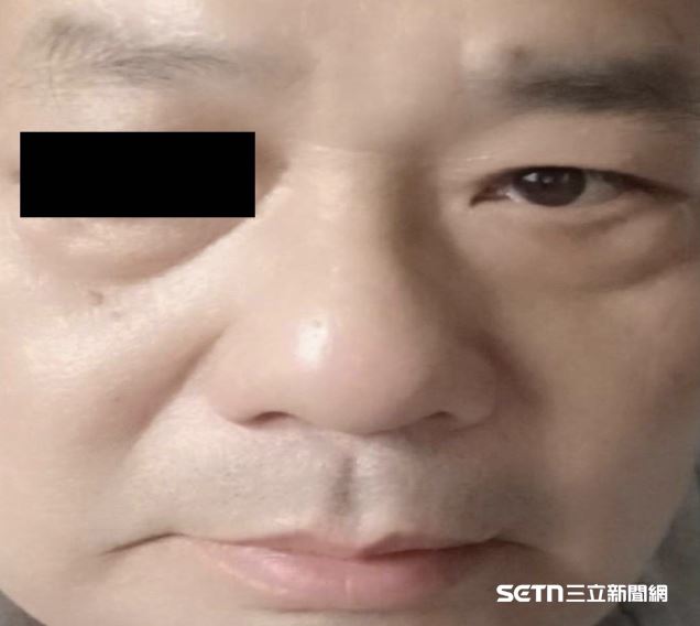 郭先生術後6個月並無復發跡象。（圖／洪啟庭提供）