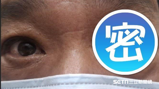 肉身二郎神？6旬男冒「第3隻眼」畫面曝光