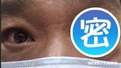 肉身二郎神？6旬男冒「第3隻眼」畫面曝光