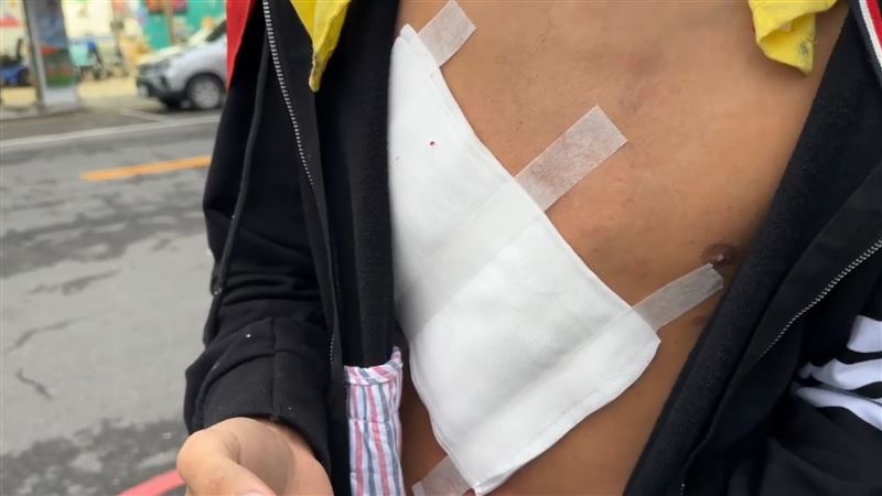 台東安善堂舉辦「炮炸寒單爺」活動，2名肉身寒單爺遭炸傷。（圖／記者王浩源攝影）