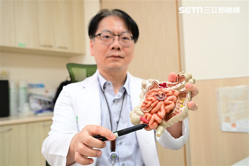 該腫瘤直徑長達10公分,且腫瘤已跟直腸壁緊貼,讓婦人看了也驚呼「沒想到肚子裡有『拍咪ㄚ』」,直說是因禍得福。(圖/翻攝畫面)