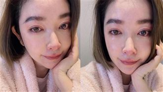 許維恩罹乳癌急切雙乳救命！IG首度發聲