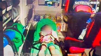 5歲童上游泳課⋯天花板割肉！小腿大噴血