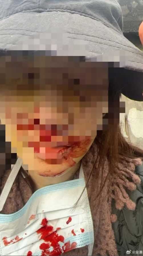 雖然經證實金晨因受傷先離開現場，並非刻意逃逸，但部分網友仍對她的舉動表示不解，質疑其責任態度。（圖／翻攝自金晨微博）