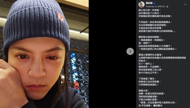 葉欣眉在臉書透露，自己因口角炎使用藥粉，一時疏忽竟把口角炎藥粉誤當成眼藥水使用。（圖／翻攝自葉欣眉FB）