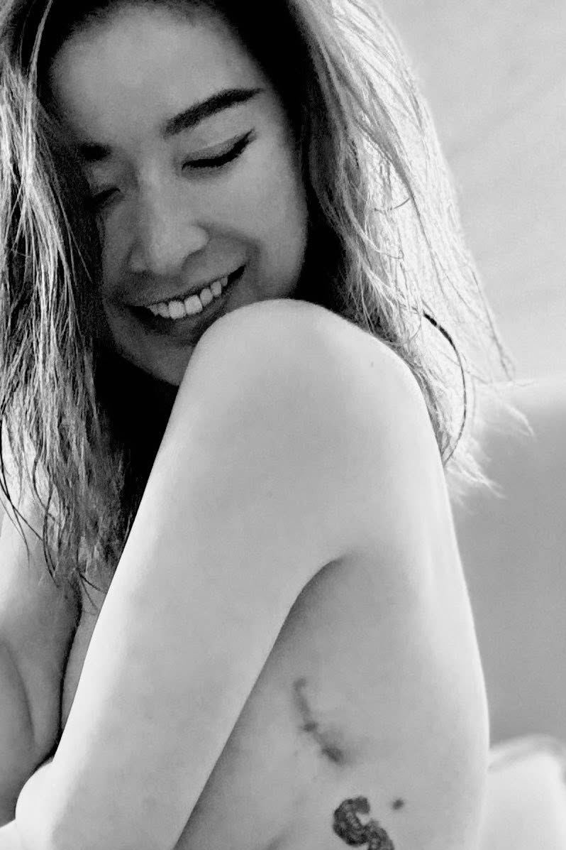 許維恩罹癌！勇敢切雙乳續命　蟹足腫留疤：生命最珍貴勳章