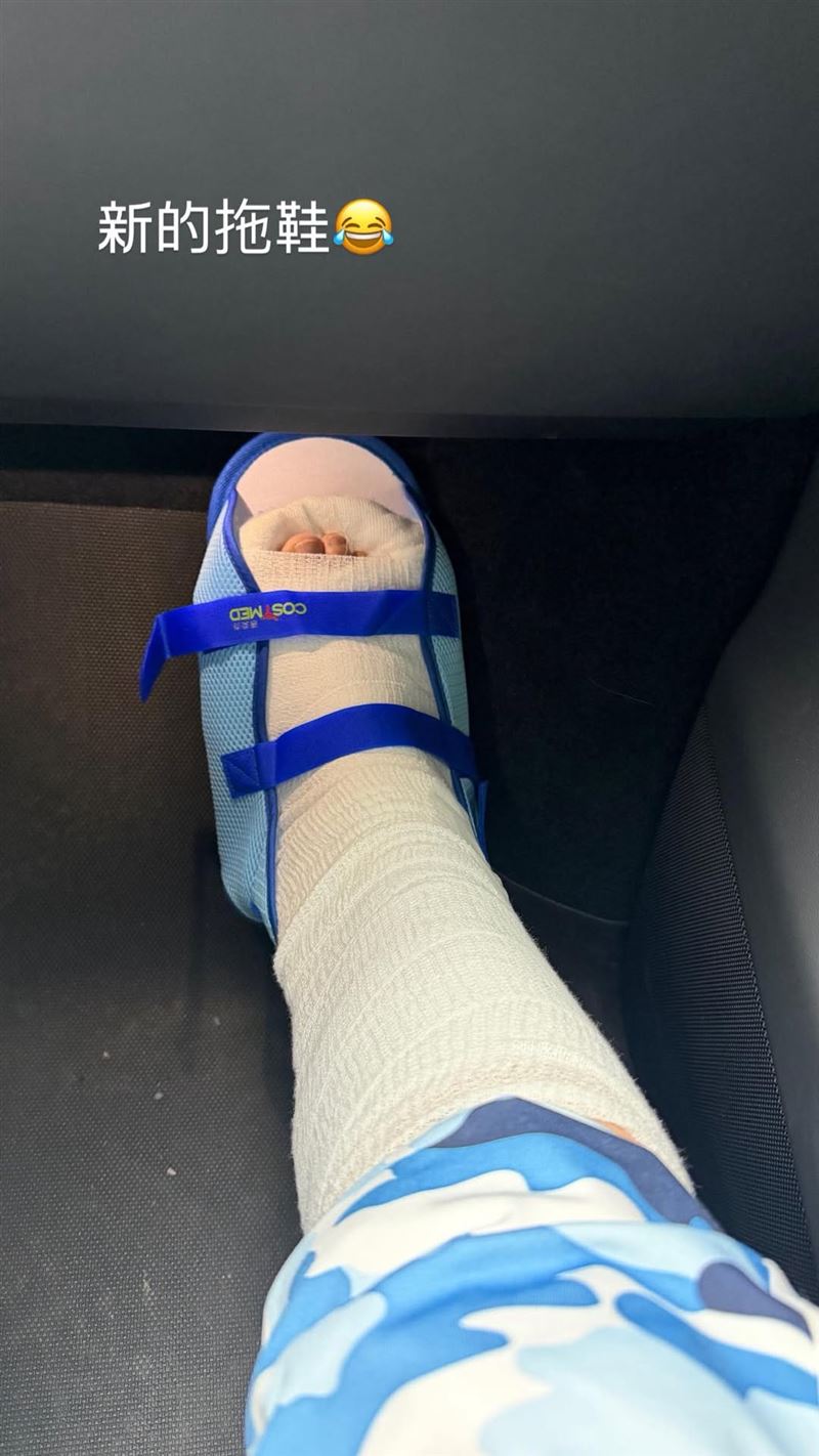 李明依傷勢曝光。（圖／翻攝自李明依臉書）