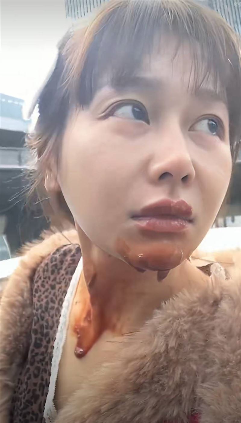 王添羽緊急到醫院治療。（圖／翻攝自微博）