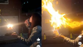模仿噴火蛋糕　女星「臉蛋遭火吻」傷勢曝