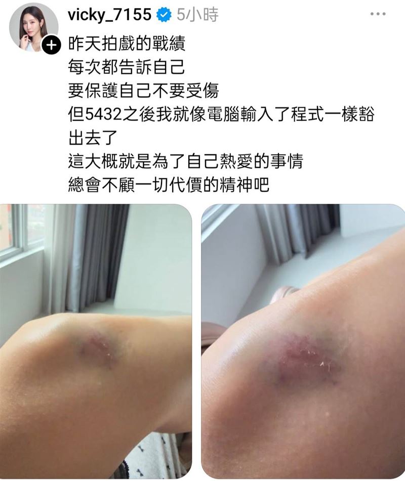 曾莞婷因為拍戲受傷。（圖／翻攝自Threads）