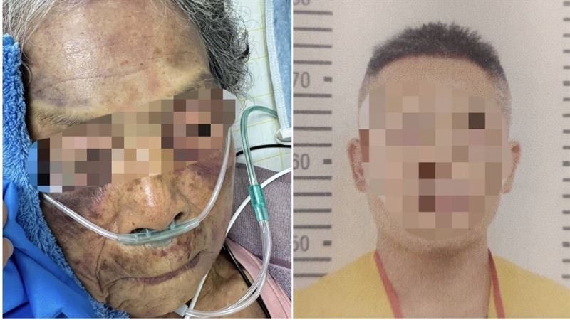 把90歲嬤打進ICU 親友悲揭:她疼孫一直忍