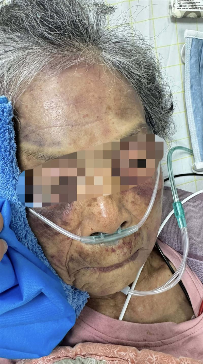 屏東縣長治鄉香楊村日前發生家暴案,高齡90歲婦人遭37歲張姓孫子徒手施暴。(圖/翻攝自臉書)