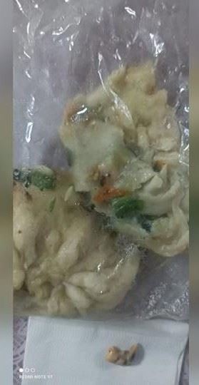 民眾大年初四購買水煎包，竟在內餡咬出帶有尖刺的「假牙」，引發社群熱議。（圖／翻攝自「台東大小事」臉書社團）