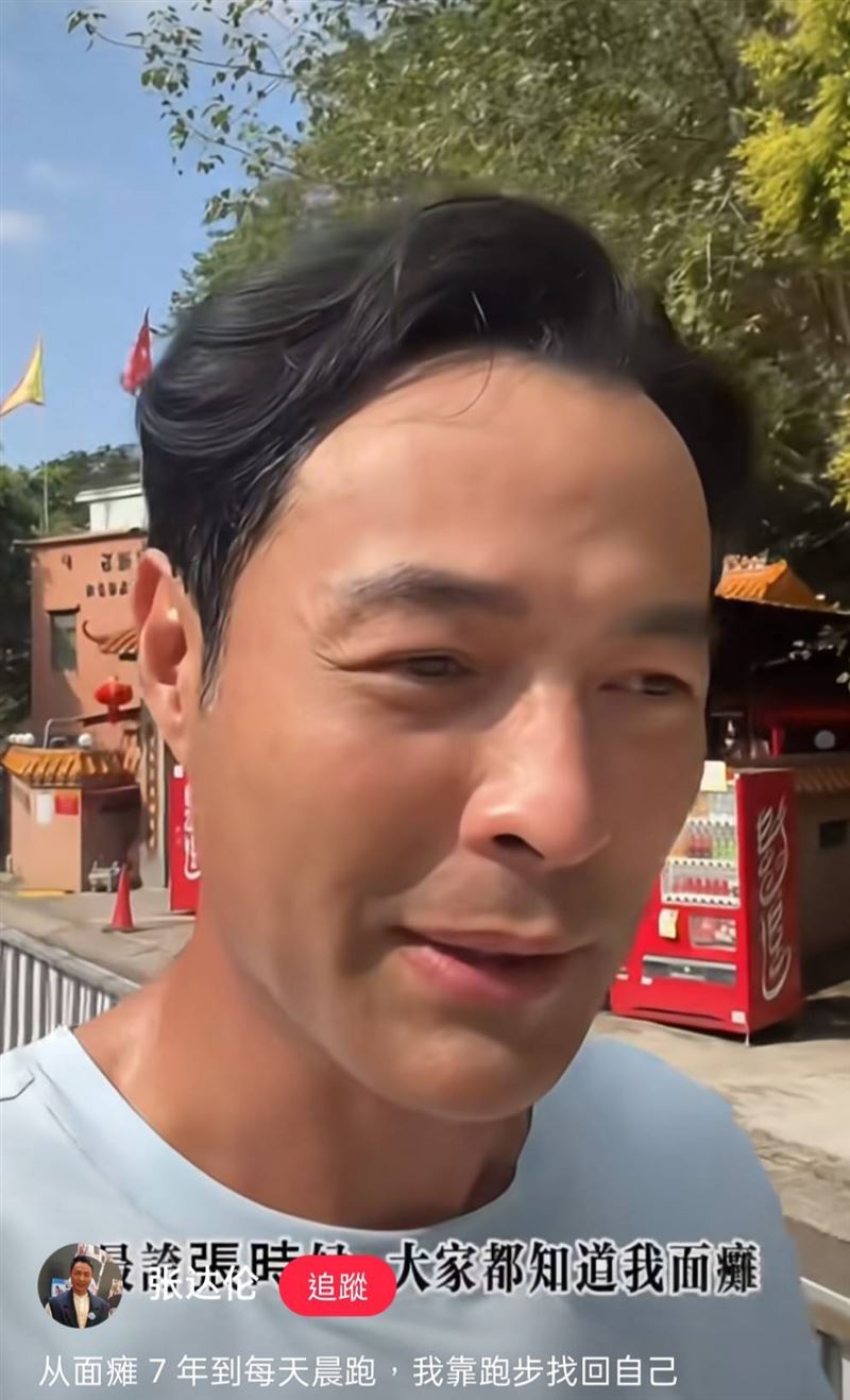 張達倫曾飽受面癱折磨。（圖／翻攝自小紅書）