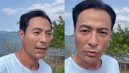 連基本喝水都無法　男星面癱7年近況曝光