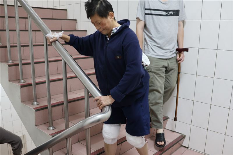 61歲婦人膝蓋關節嚴重磨損,置換人工膝蓋後,3天即可下床。(圖 /大甲李綜合醫院提供)