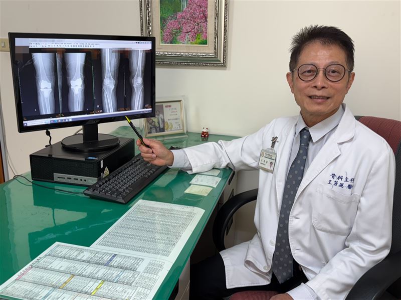 患有退化性關節炎的61歲婦人,軟骨突然脫落,導致無法站立。(圖 /大甲李綜合醫院提供)