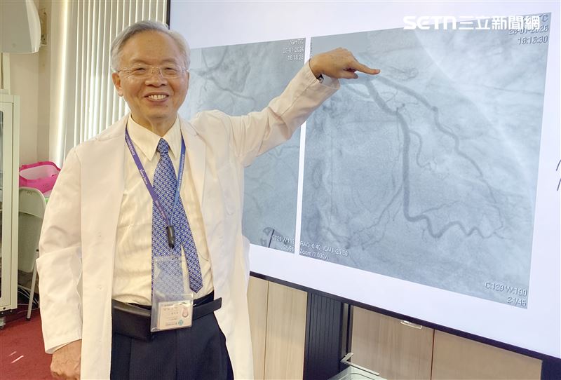 李文領主任強調，許多民眾誤以為放支架後就痊癒了，其實支架只是撐開血管、維持血流，動脈硬化體質並未改變，阻塞可能再發生或惡化。(圖/翻攝畫面)